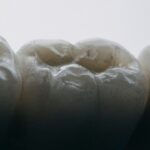 Cum să interpretezi visele despre pierderea dinților