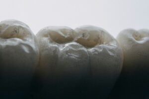 Photo interpret dreams about losing teeth