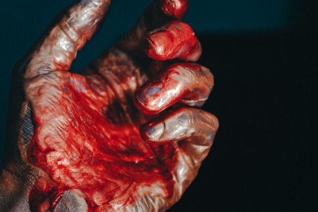 Photo stigmata bleeding